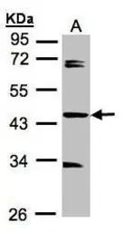 Anti-SDCCAG3 antibody [C1C3] used in Western Blot (WB). GTX106180