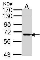 Anti-MIPP antibody [C1C3] used in Western Blot (WB). GTX106186