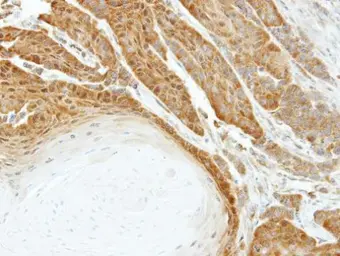 Anti-HSPA6 antibody [C1C3] used in IHC (Paraffin sections) (IHC-P). GTX106192
