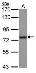 Anti-HSPA6 antibody [C1C3] used in Western Blot (WB). GTX106192