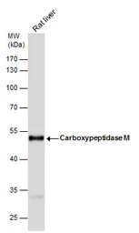 Anti-Carboxypeptidase M antibody [N1C2] used in Western Blot (WB). GTX106203