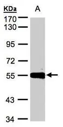 Anti-Carboxypeptidase M antibody [N1C2] used in Western Blot (WB). GTX106203