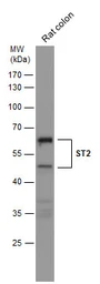 Anti-ST2 antibody [N1C1] used in Western Blot (WB). GTX106204