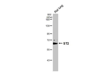 Anti-ST2 antibody [N1C1] used in Western Blot (WB). GTX106204
