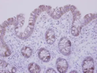 Anti-CCDC83 antibody used in IHC (Paraffin sections) (IHC-P). GTX106217