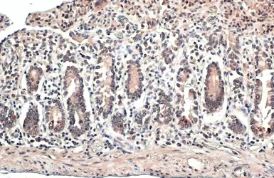 Anti-ERR alpha antibody [N1C3] used in IHC (Paraffin sections) (IHC-P). GTX106233