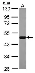 Anti-ERR alpha antibody [N1C3] used in Western Blot (WB). GTX106233