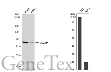 Anti-CD2AP antibody used in Western Blot (WB). GTX106235