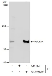 Anti-POLR3A antibody used in Immunoprecipitation (IP). GTX106241