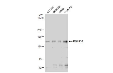 Anti-POLR3A antibody used in Western Blot (WB). GTX106241