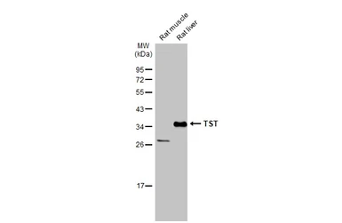 Anti-TST antibody used in Western Blot (WB). GTX106257
