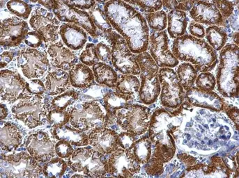 Anti-TST antibody used in IHC (Paraffin sections) (IHC-P). GTX106257