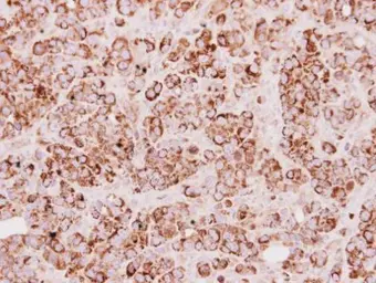 Anti-TST antibody used in IHC (Paraffin sections) (IHC-P). GTX106257