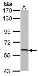 Anti-HABP2 antibody used in Western Blot (WB). GTX106265