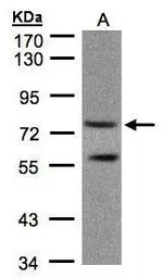 Anti-PDE4C antibody [N3C3] used in Western Blot (WB). GTX106268