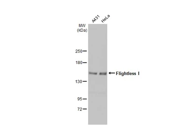 Anti-Flightless I antibody [N3C1], Internal used in Western Blot (WB). GTX106269