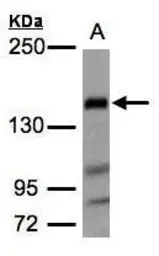 Anti-Flightless I antibody [N3C1], Internal used in Western Blot (WB). GTX106269