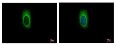 Anti-ZDHHC13 antibody [C3], C-term used in Immunocytochemistry/ Immunofluorescence (ICC/IF). GTX106273