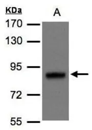 Anti-DISC1 antibody [N1], N-term used in Western Blot (WB). GTX106286