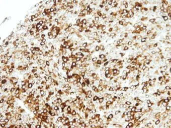 Anti-STAP2 antibody [C3], C-term used in IHC (Paraffin sections) (IHC-P). GTX106287