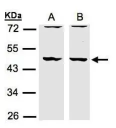 Anti-HIP55 antibody [N1], N-term used in Western Blot (WB). GTX106288