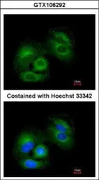 Anti-SIRT3 antibody [C3], C-term used in Immunocytochemistry/ Immunofluorescence (ICC/IF). GTX106292