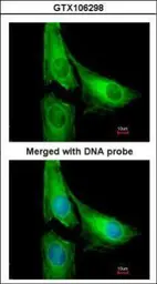 Anti-AGAP1 antibody [C3], C-term used in Immunocytochemistry/ Immunofluorescence (ICC/IF). GTX106298