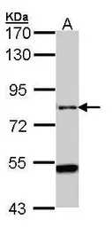 Anti-AGAP1 antibody [C3], C-term used in Western Blot (WB). GTX106298
