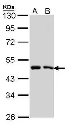 Anti-SIL1 antibody [C3], C-term used in Western Blot (WB). GTX106300