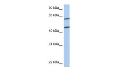 Anti-Netrin 4 antibody, N-term used in Western Blot (WB). GTX10631