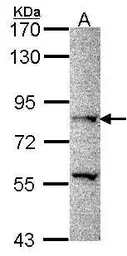 Anti-PRDM8 antibody [N1], N-term used in Western Blot (WB). GTX106318