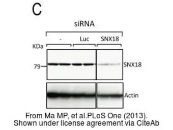 Anti-SNX18 antibody [C3], C-term used in Western Blot (WB). GTX106319
