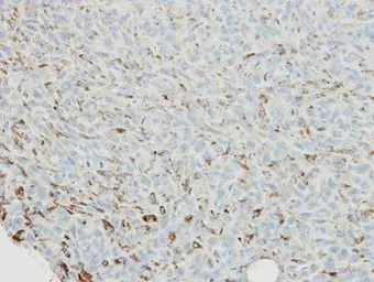 Anti-SNX18 antibody [C3], C-term used in IHC (Paraffin sections) (IHC-P). GTX106319