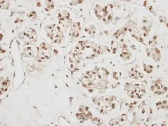 Anti-CBP80 antibody [N2], N-term used in IHC (Paraffin sections) (IHC-P). GTX106328