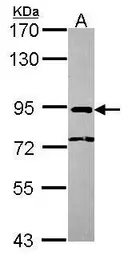 Anti-CBP80 antibody [N2], N-term used in Western Blot (WB). GTX106328