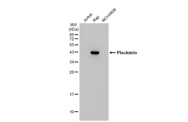 Anti-Pleckstrin antibody [C2C3], C-term used in Western Blot (WB). GTX106332