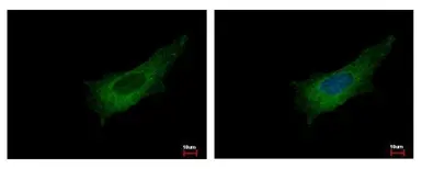 Anti-Pleckstrin antibody [C2C3], C-term used in Immunocytochemistry/ Immunofluorescence (ICC/IF). GTX106332