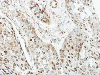 Anti-RanGAP1 antibody [N1], N-term used in IHC (Paraffin sections) (IHC-P). GTX106338