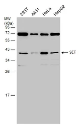 Anti-SET antibody, isoform 2-specific used in Western Blot (WB). GTX106342