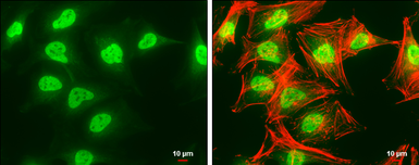Anti-SET antibody, isoform 2-specific used in Immunocytochemistry/ Immunofluorescence (ICC/IF). GTX106342