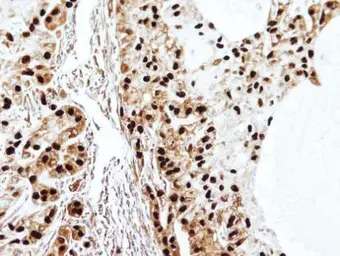 Anti-SET antibody, isoform 2-specific used in IHC (Paraffin sections) (IHC-P). GTX106342