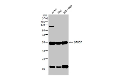Anti-BAF57 antibody [C3], C-term used in Western Blot (WB). GTX106345
