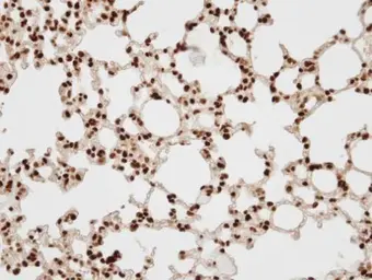 Anti-BAF57 antibody [C3], C-term used in IHC (Paraffin sections) (IHC-P). GTX106345
