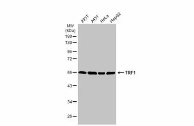 Anti-TRF1 antibody [C3], C-term used in Western Blot (WB). GTX106349