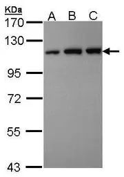 Anti-VDP / p115 antibody [C3], C-term used in Western Blot (WB). GTX106355