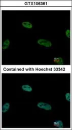 Anti-TRIP15 antibody used in Immunocytochemistry/ Immunofluorescence (ICC/IF). GTX106361