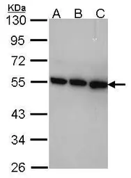Anti-TRIP15 antibody used in Western Blot (WB). GTX106361