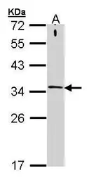 Anti-Syntaxin 1a antibody [N1], N-term used in Western Blot (WB). GTX106365