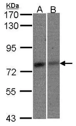 Anti-MTA2 antibody [C3], C-term used in Western Blot (WB). GTX106367