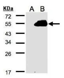 Anti-PAMCI antibody [C3], C-term used in Western Blot (WB). GTX106375